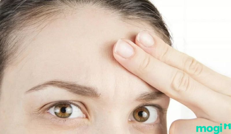 Thịt giật ở trán