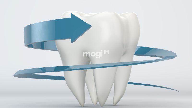 Nằm Mơ Thấy Gãy Răng Có Ý Nghĩa Gì? Lời Giải Mã Chi Tiết 2 Vì sao mơ thấy mình bị gãy răng?