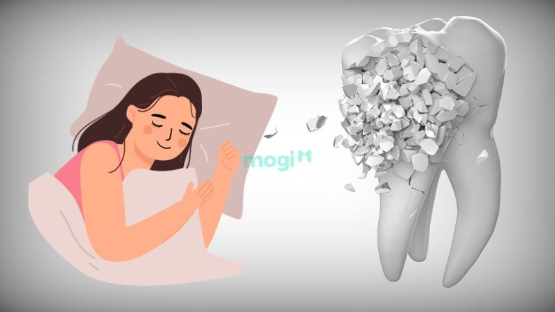 Nằm Mơ Thấy Gãy Răng Có Ý Nghĩa Gì? Lời Giải Mã Chi Tiết 3 Mơ thấy răng bị gãy và vỡ thành nhiều mảnh