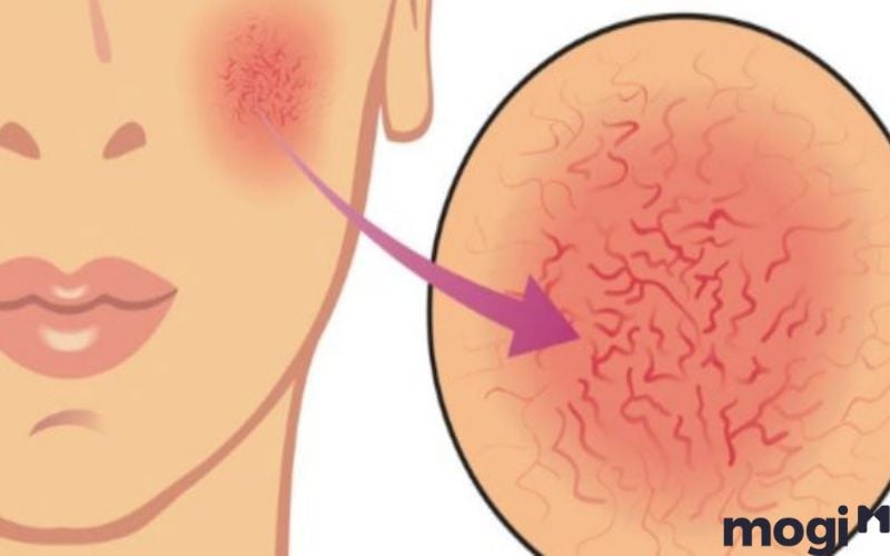 Nằm Mơ Thấy Máu Là Điềm Gì? Điềm Tốt Hay Xấu? Giải Mã Giấc Mơ 4 Ngủ mơ thấy máu trên mặt