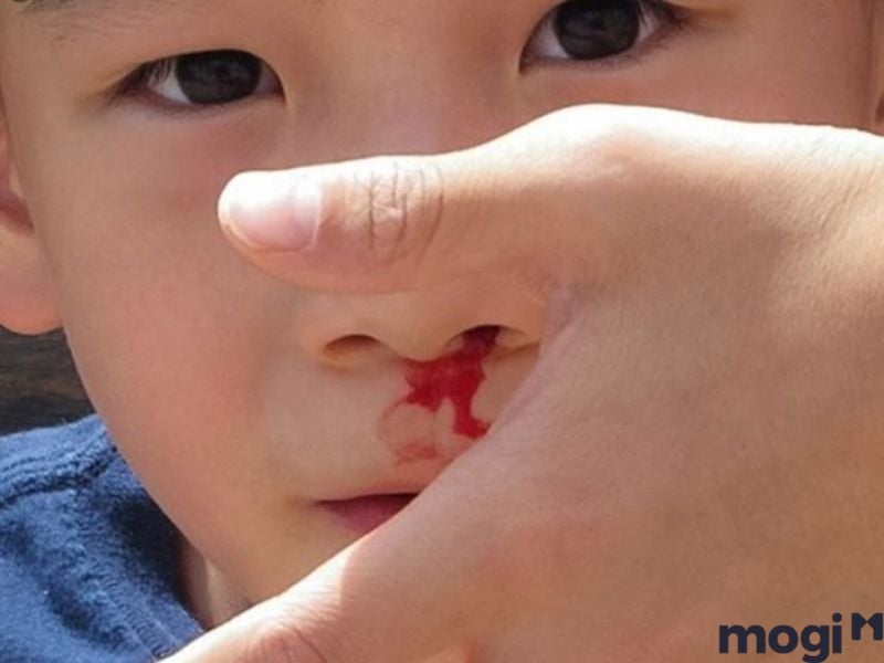 Nằm Mơ Thấy Máu Là Điềm Gì? Điềm Tốt Hay Xấu? Giải Mã Giấc Mơ 9 Mơ thấy người khác chảy máu