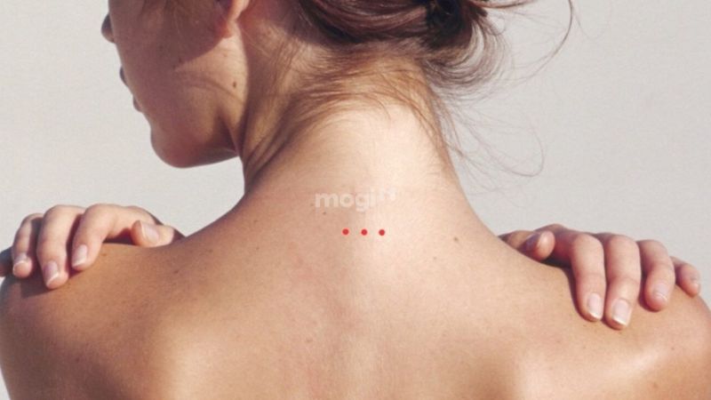 3 nốt ruồi thẳng hàng: Giải mã từng vị trí nốt ruồi trên cơ thể 4 Nốt ruồi sau gáy