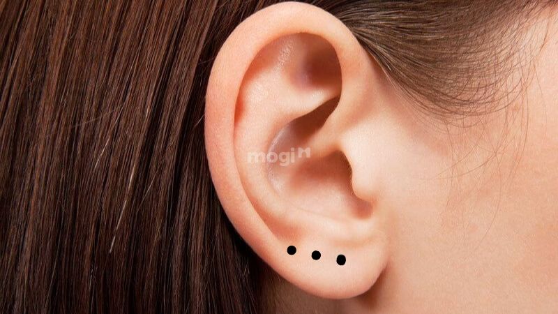 3 nốt ruồi thẳng hàng: Giải mã từng vị trí nốt ruồi trên cơ thể 7 Nốt ruồi trên dái tai