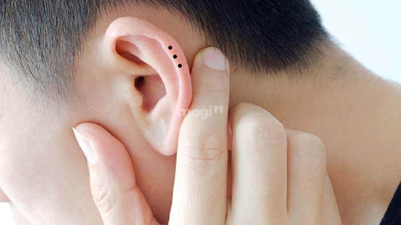 3 nốt ruồi thẳng hàng: Giải mã từng vị trí nốt ruồi trên cơ thể 8 Nốt ruồi trên vành tai