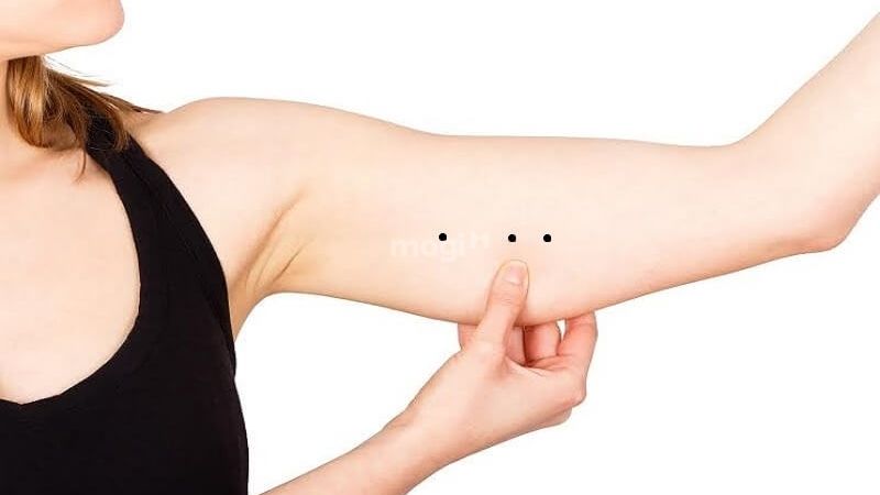 3 nốt ruồi thẳng hàng: Giải mã từng vị trí nốt ruồi trên cơ thể 10 Nốt ruồi trên cánh tay