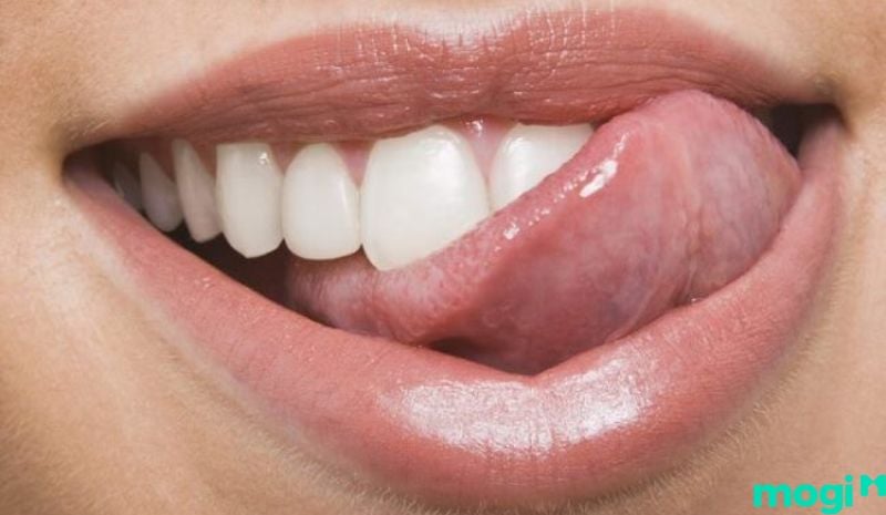 Cắn vào lưỡi là điềm gì- Khi xét theo khía cạnh khoa học