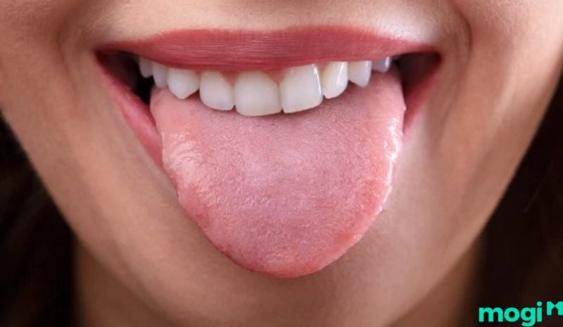 Cắn vào lưỡi dẫn đến chảy máu là điềm báo không tốt