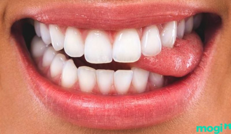 Cắn vào lưỡi là điềm gì - Việc cắn vào lưỡi có thể gây ra nguy hiểm nếu vết cắn đó lớn hoặc sâu