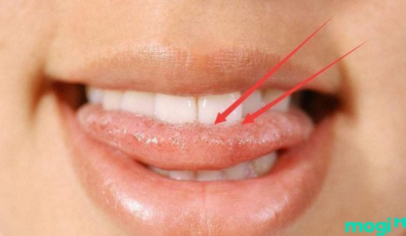 Cắn vào lưỡi là điềm gì- Khi xét theo khía cạnh tâm linh