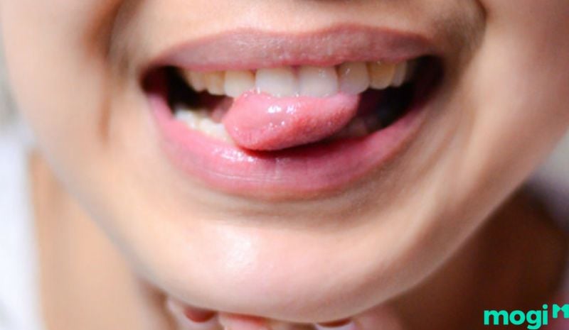 Hình ảnh về máu mang lại điềm gỡ
