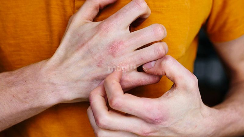 Ngứa lòng bàn tay phải là điềm gì? Cách xử lý hiệu quả 3 Cách xử lý khi bị ngứa lòng bàn tay phải