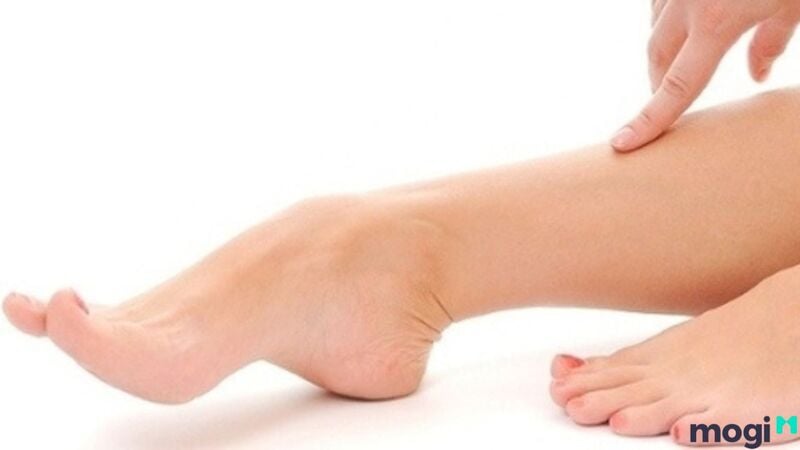 Tướng bàn chân lõm