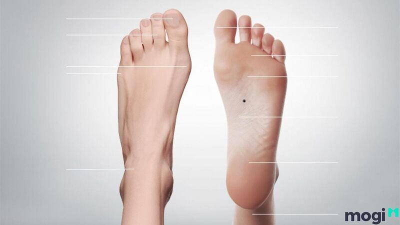 Tướng bàn chân to