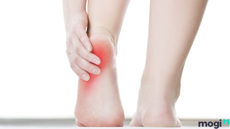 Tướng hoa bàn chân