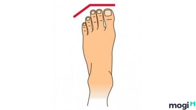 Tướng bàn chân 3 ngón đầu tiên gần bằng nhau